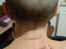 O migrenie i goleniu głowy