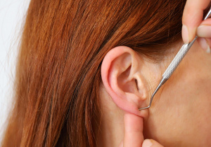 klawiterapia, aurikuloterapia