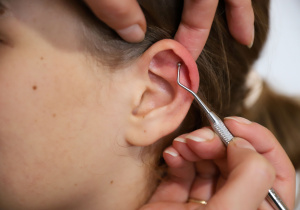 szumy uszne, klawiterapia